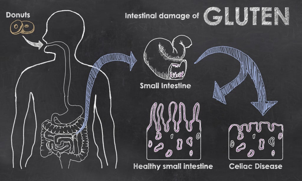 What is Celiac Disease Diagram