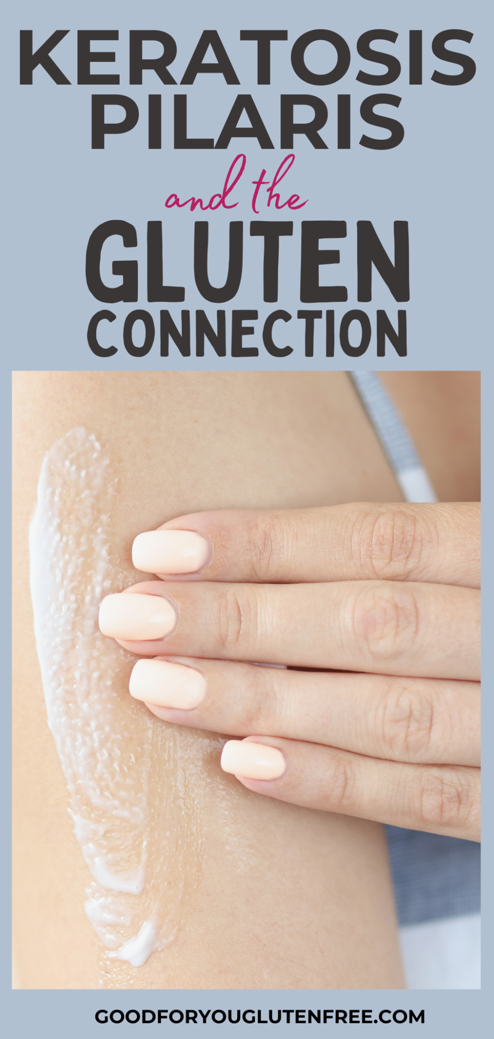 Keratosis Pilaris and the Gluten (Celiac Disease) Connection Good For